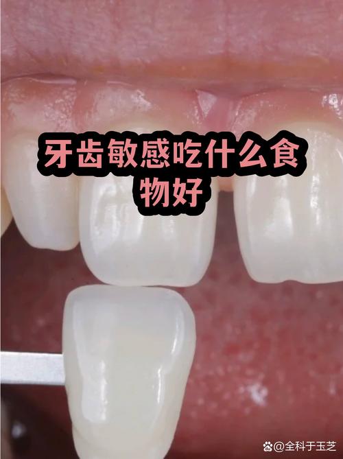 高钙乳制品:牛奶,奶酪等富含钙质,有助于修